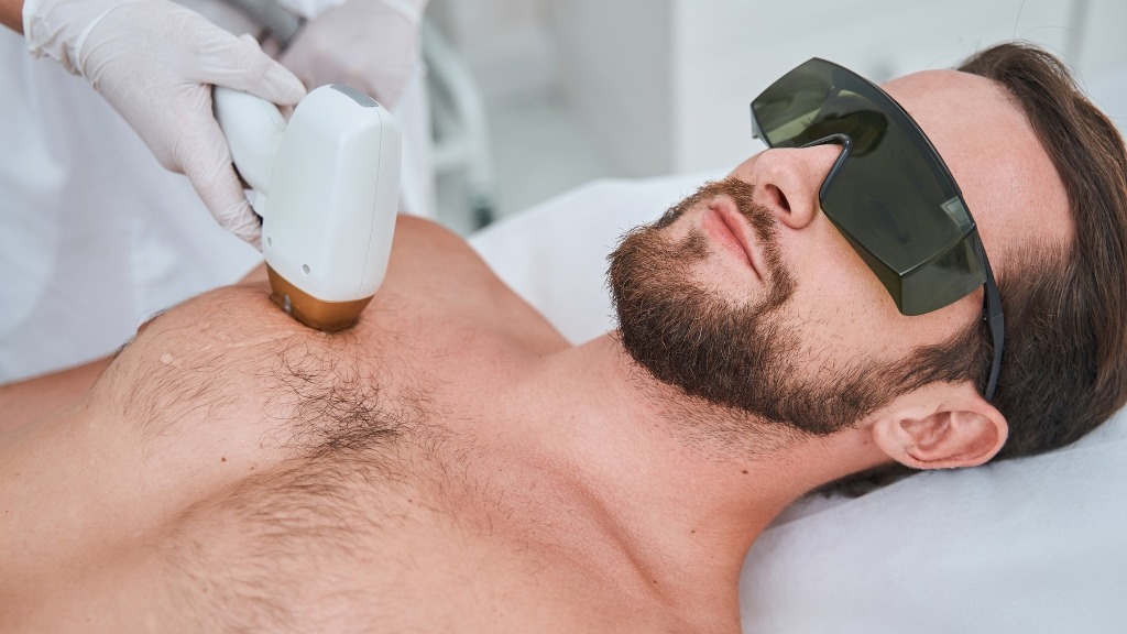 Chest Hair Removal for Men: The Complete Guide to Laser Treatment