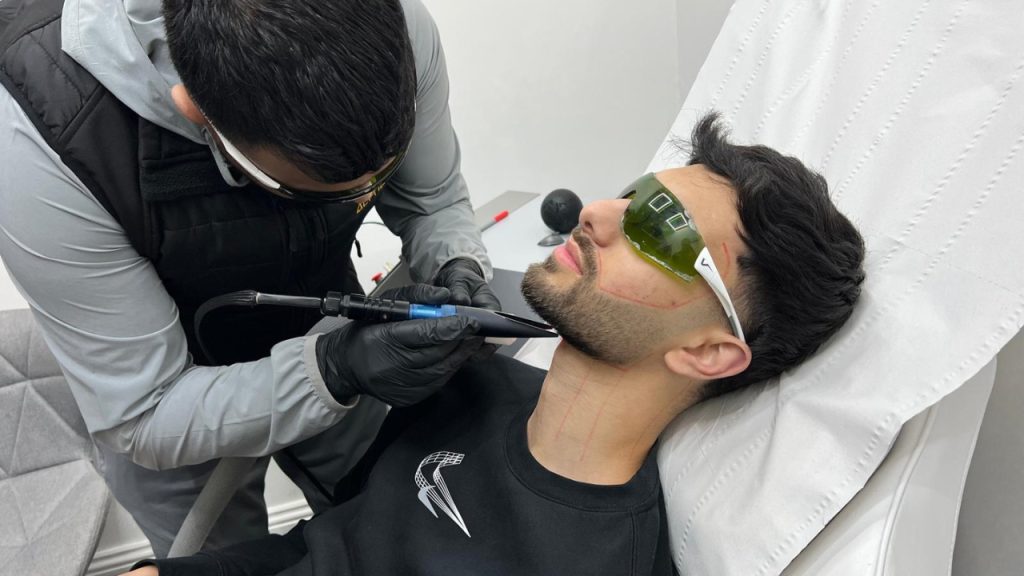 Is Laser Hair Removal Safe for Darker Skin? The Honest Answer for Men