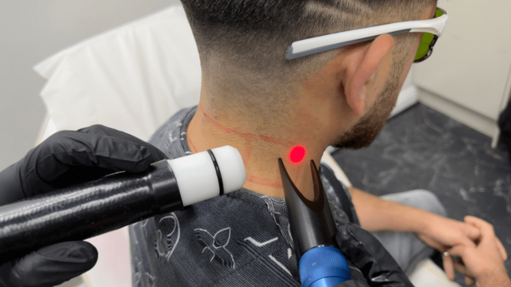 Laser Hair Removal Doesn’t Work on Every Hair Colour: Here’s Why