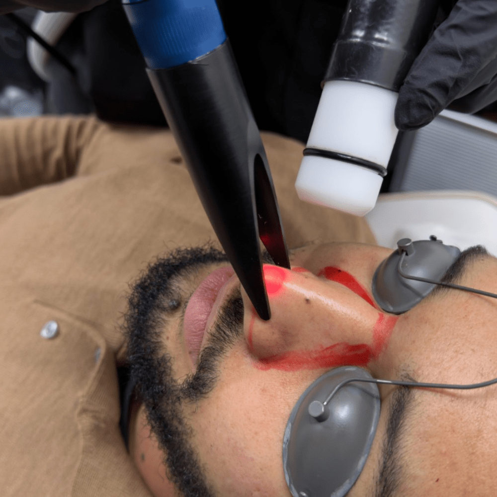 Recovery After Laser Hair Removal: Complete Aftercare Guide