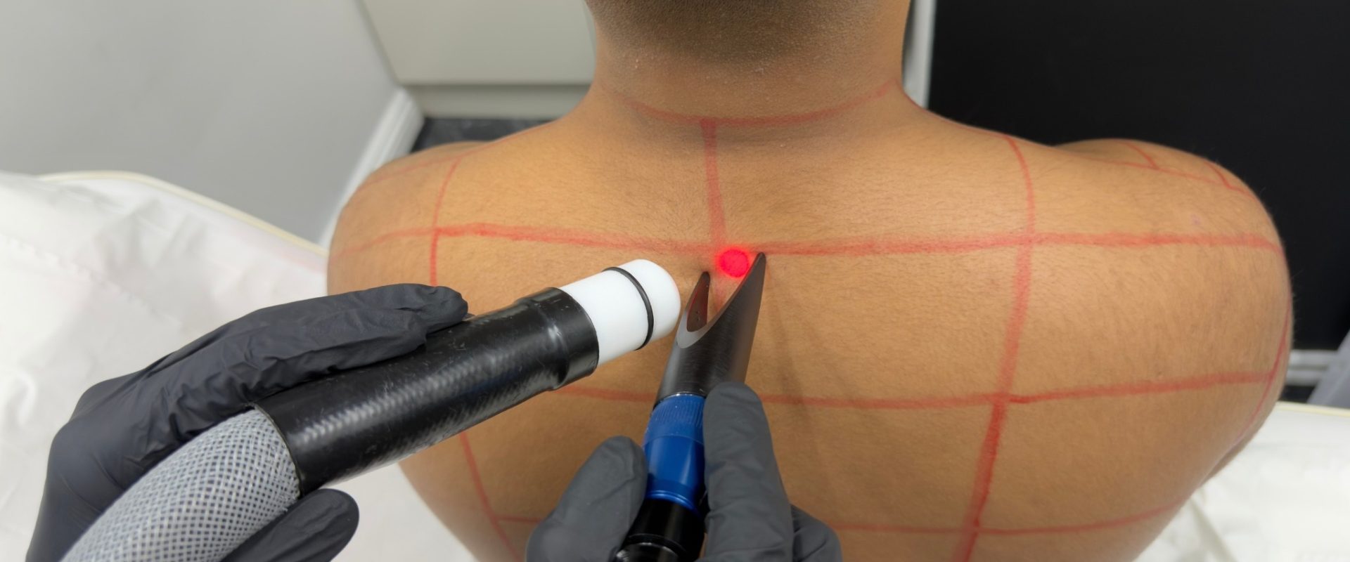 Laser Hair Removal for Men in Their 40s and 50s: What Changes