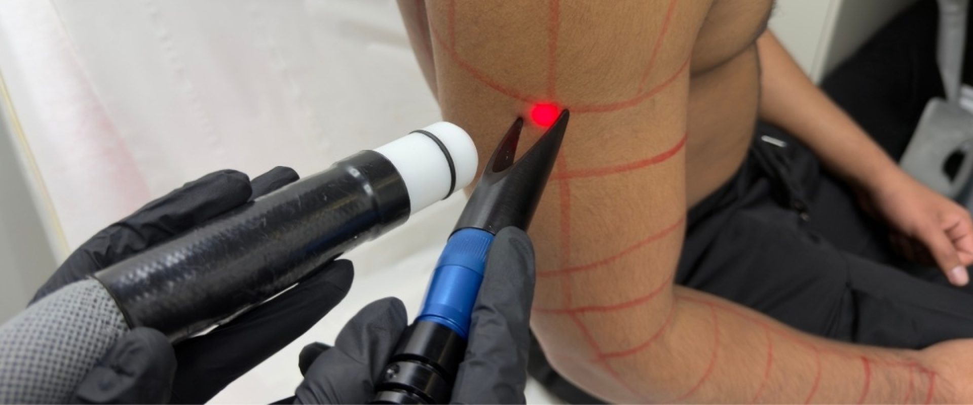 From Irritation to Confidence A Client’s Journey with Alpha Laser Clinic