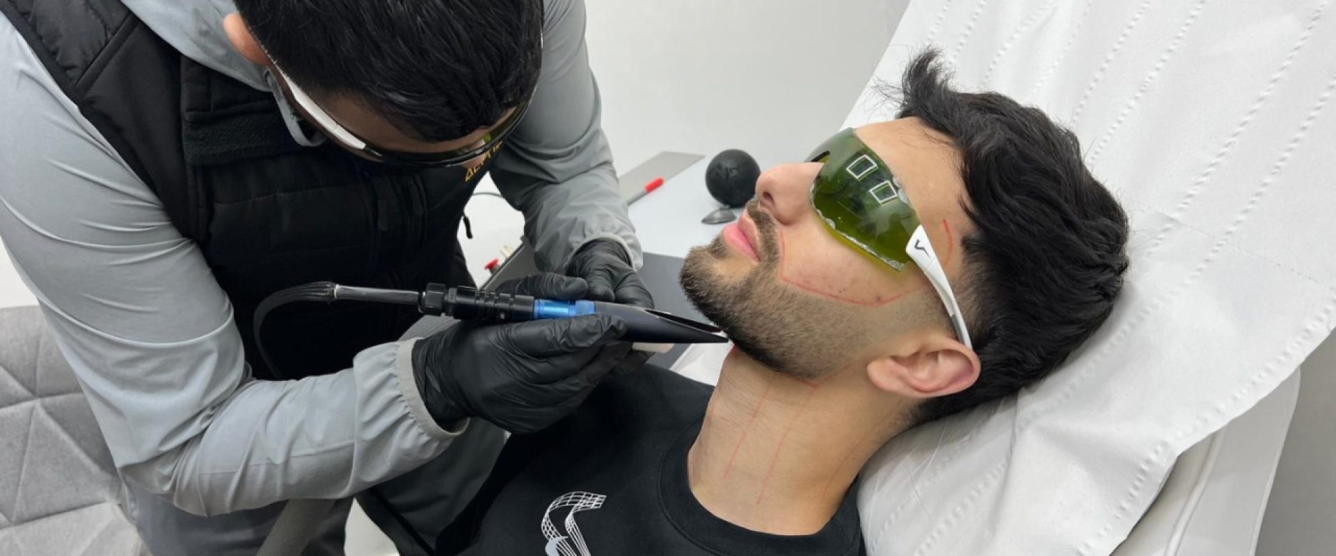Is Laser Hair Removal Safe for Darker Skin? The Honest Answer for Men