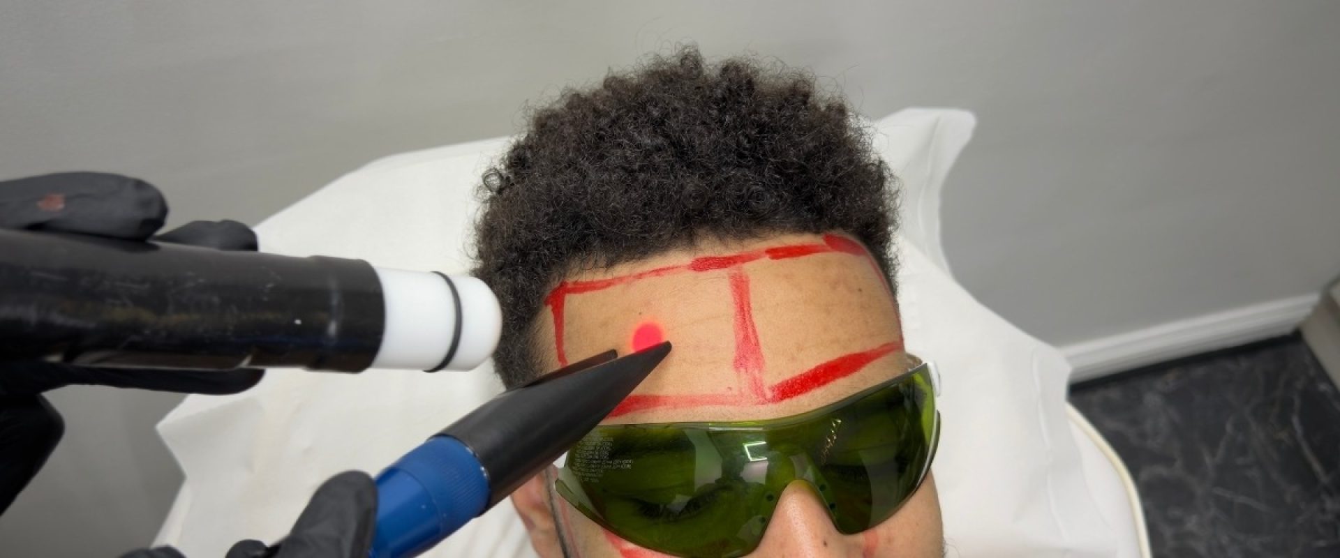 Post Laser Aftercare & Skin Recovery How to Protect and Maximise Your Results (1)