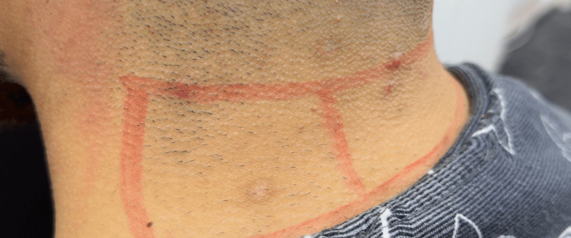 Laser Hair Removal for Busy Professionals: Fitting Grooming Into a Working Week